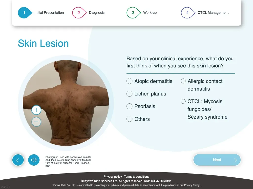 Zoomable skin lesion image with differential diagnosis multiple-choice question