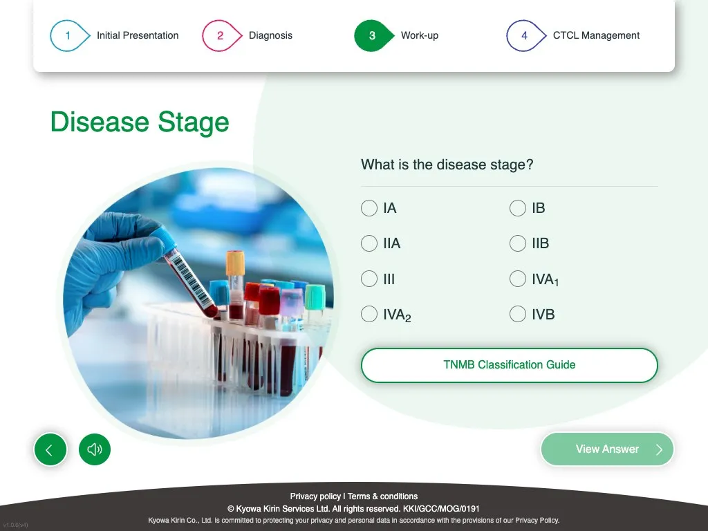 Disease stage multiple-choice question with TNMB classification guide button