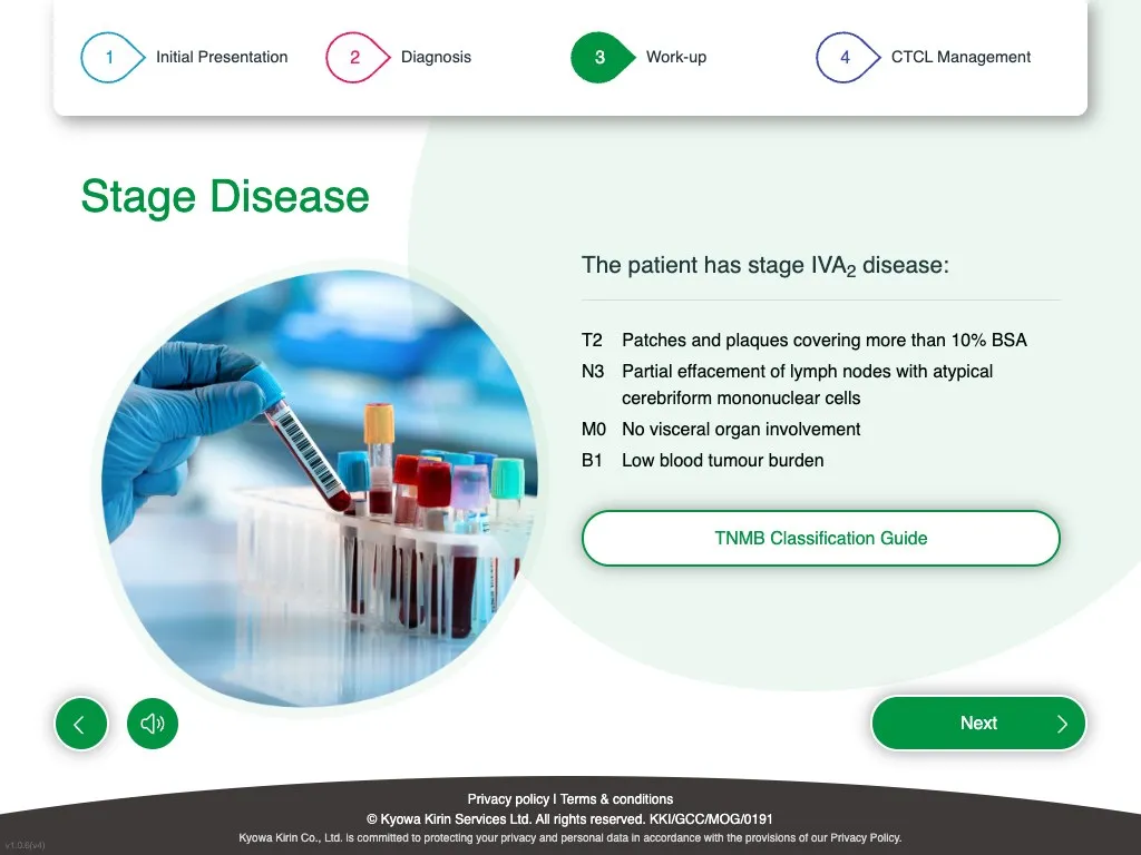 Stage disease answer explaining stage IVA2 with TNMB factors
